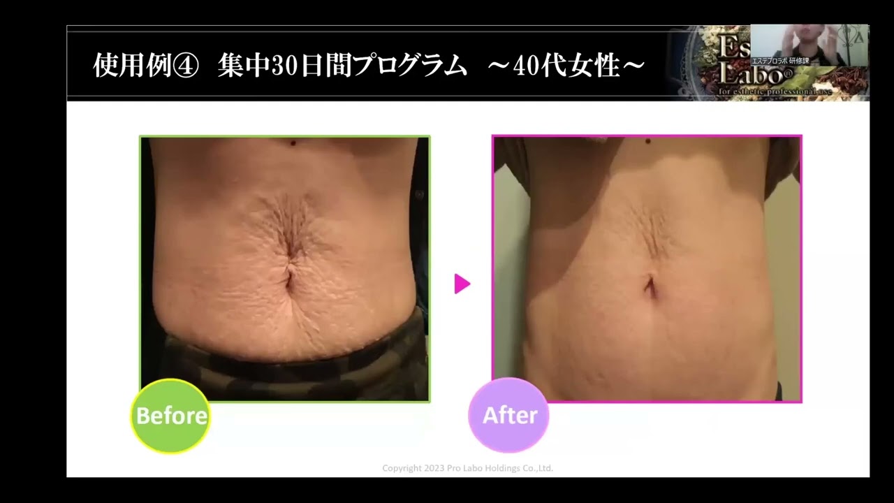 Esthe Pro Labo X RHYTHM | ボディーオープレミア 200g