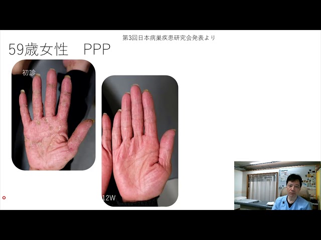 Doctor's explanation] There is a big difference between 