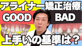 アライナー矯正治療の上手い、下手は何で決まる？歯科医師向け - YouTube