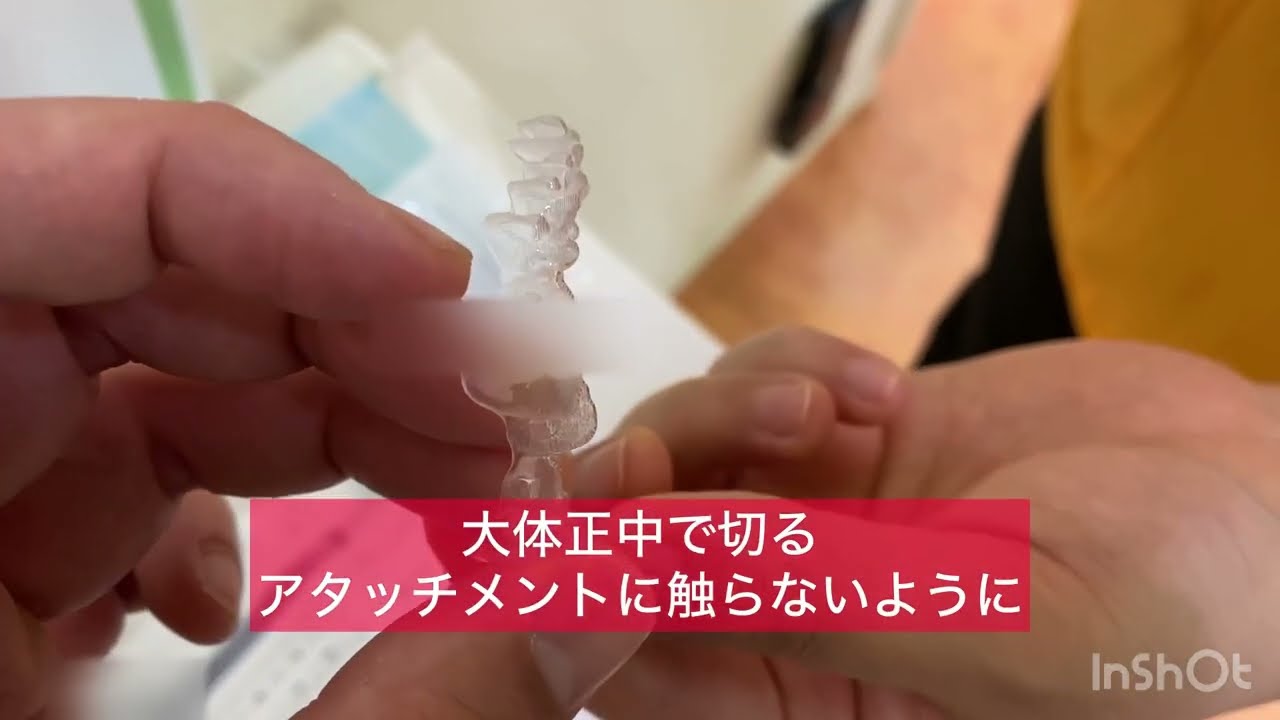 インビザラインアタッチメントセットの準備① - YouTube