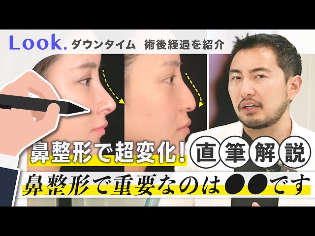 Nose surgery] Nose surgery can dramatically change your appearance