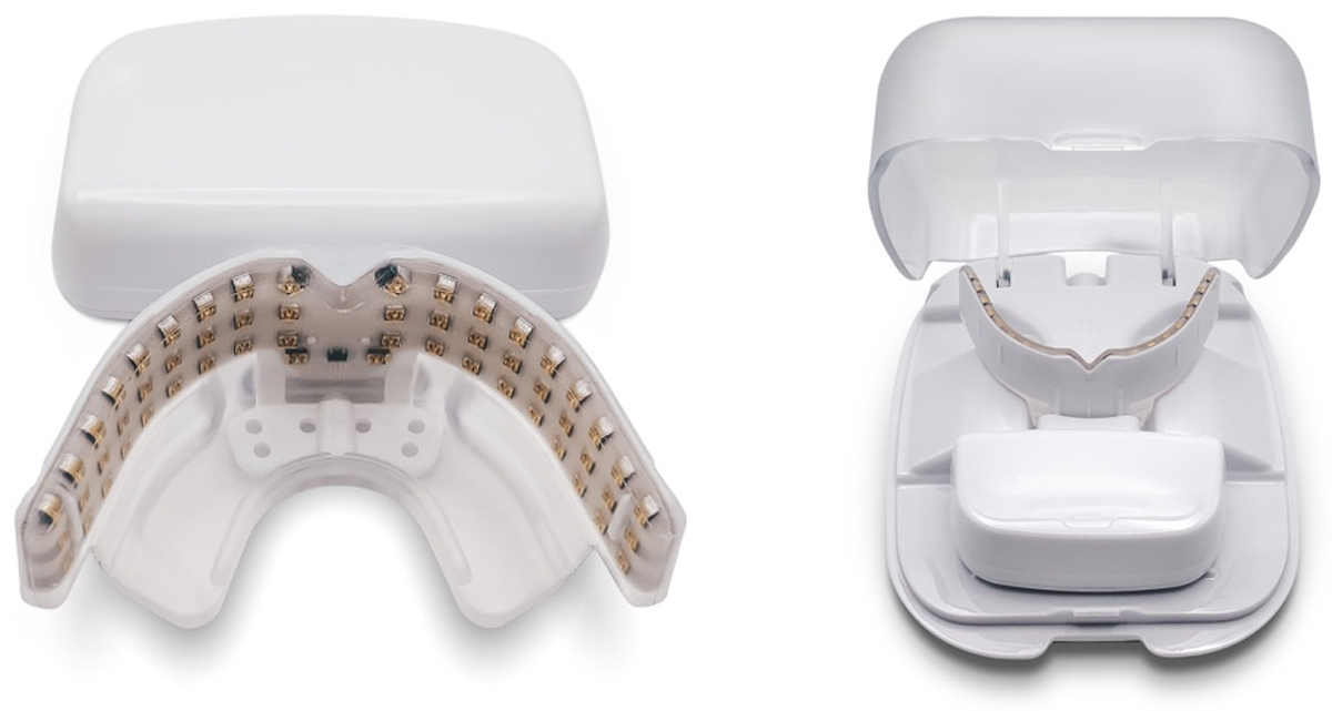 光加速矯正装置（オルソパルス） | 五十嵐歯科室