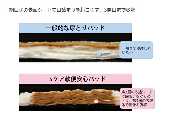 アテント Sケア軟便安心パッド 20枚入 大人用紙おむつ 尿取りパッド