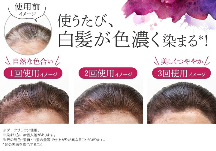 楽天市場】【店内P最大65倍以上開催】【DHC直販】DHC Q10プレミアム