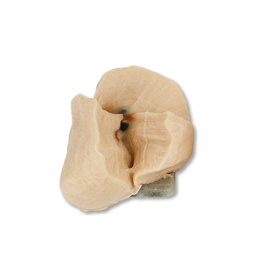 VTT-肺モデル(右) 【VTT-LUN00001】 腹腔鏡トレーニングボックスのお店