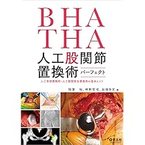 TKA・UKA 人工膝関節置換術パーフェクト〜人工膝関節全置換術・人工膝