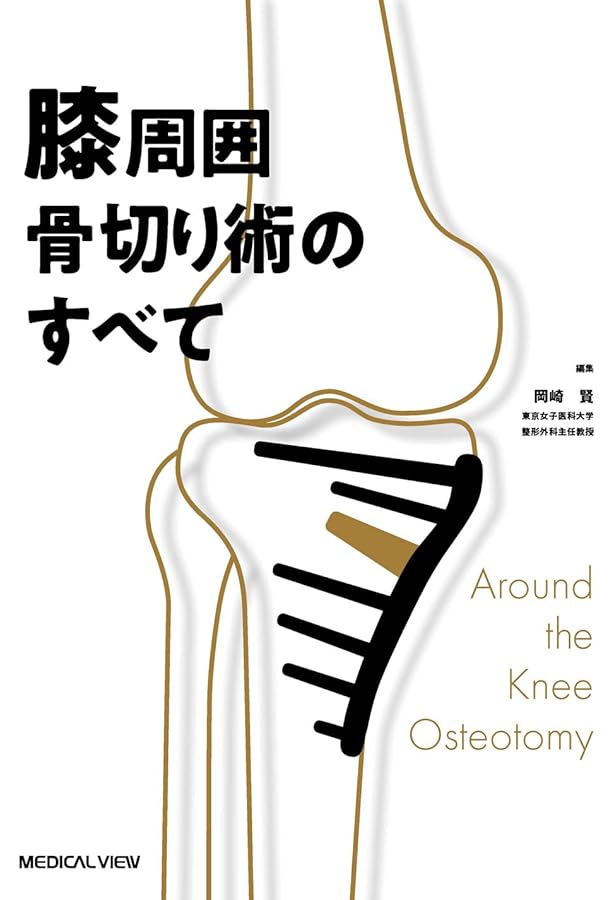 TKA・UKA 人工膝関節置換術パーフェクト〜人工膝関節全置換術・人工膝