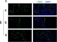CD31 Antibody (PECAM-1) (D8V9E) XP® Rabbit mAb | Cell Signaling