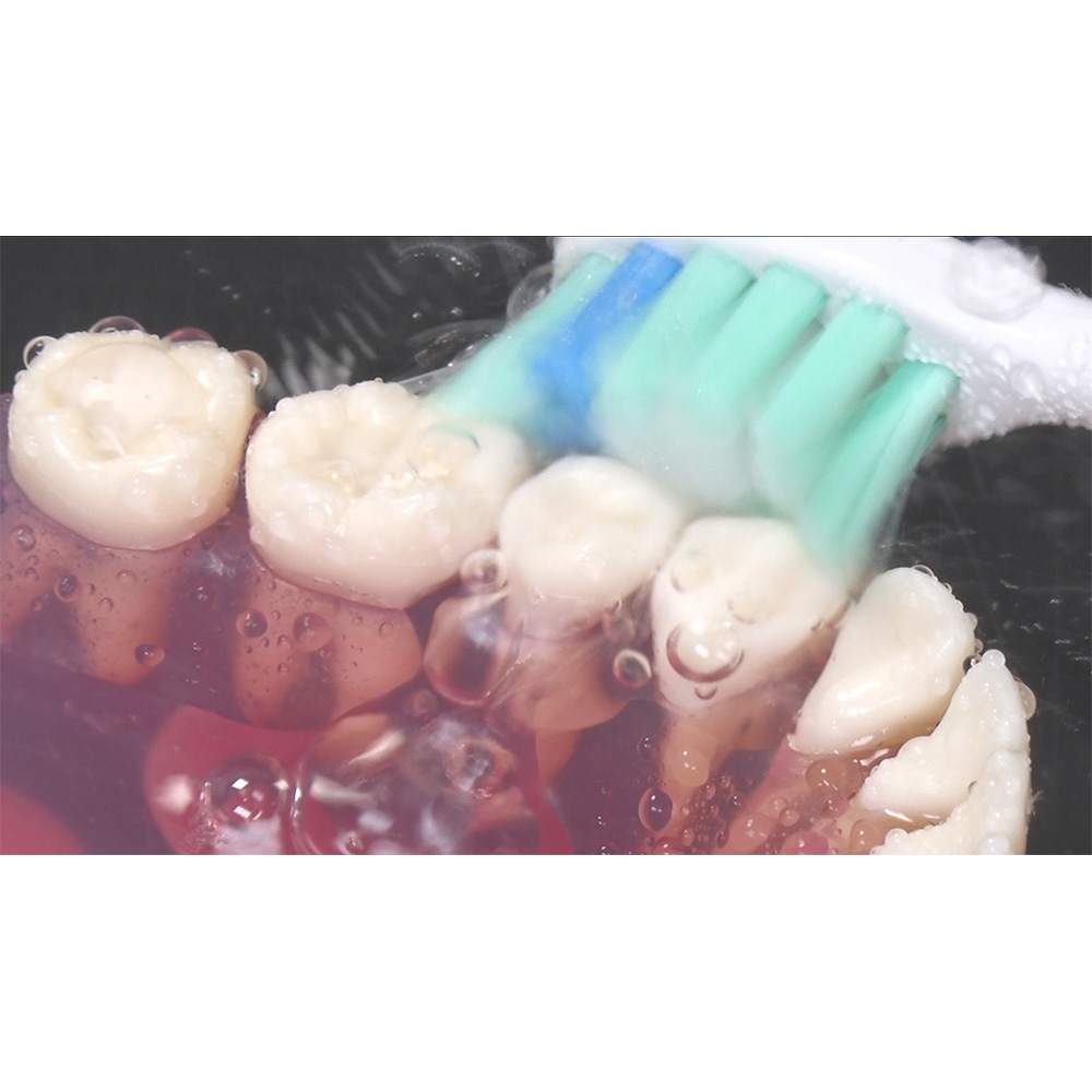 音波振動歯ブラシ シャインピュア 特別セット 通販 - ディノス