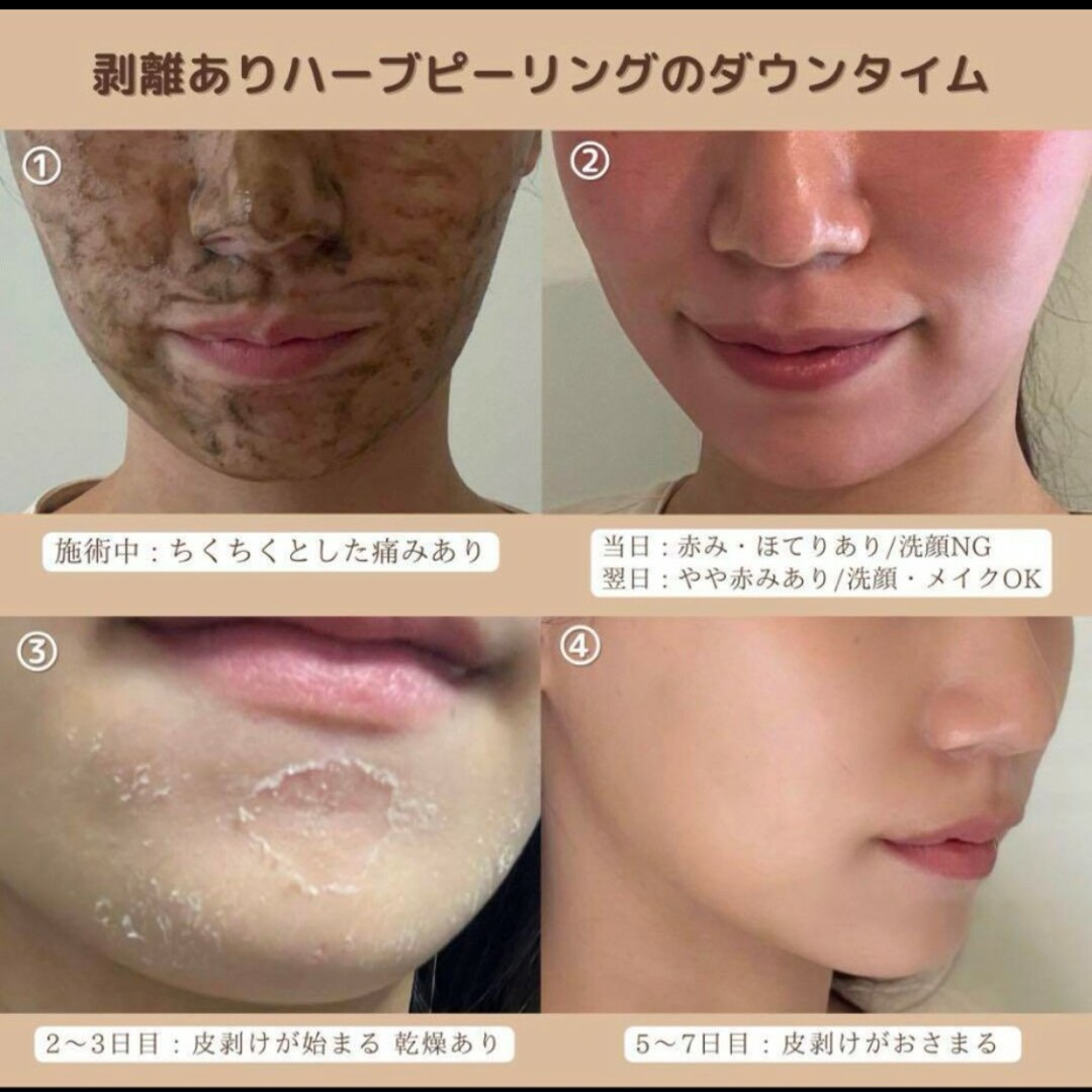 剥離ありハーブピーリングの通販 by a即購入可能｜ラクマ
