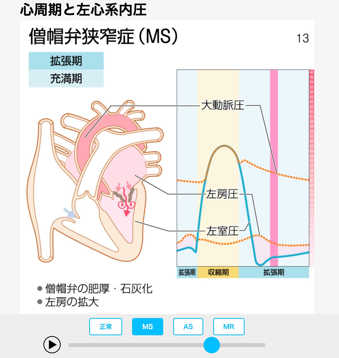 新刊（改訂版）］『病気がみえるvol.2 循環器（第6版）』本日発売