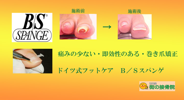 巻き爪専門 東京