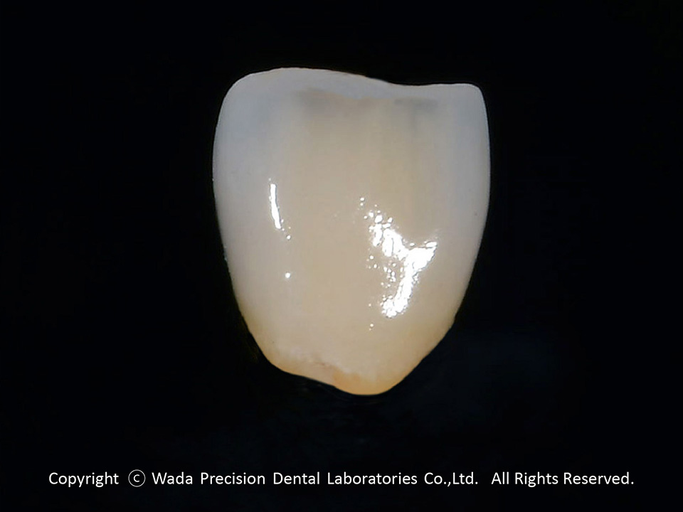 ZR-M ジルコニアマルチレイヤー - 【公式】和田精密歯研株式会社