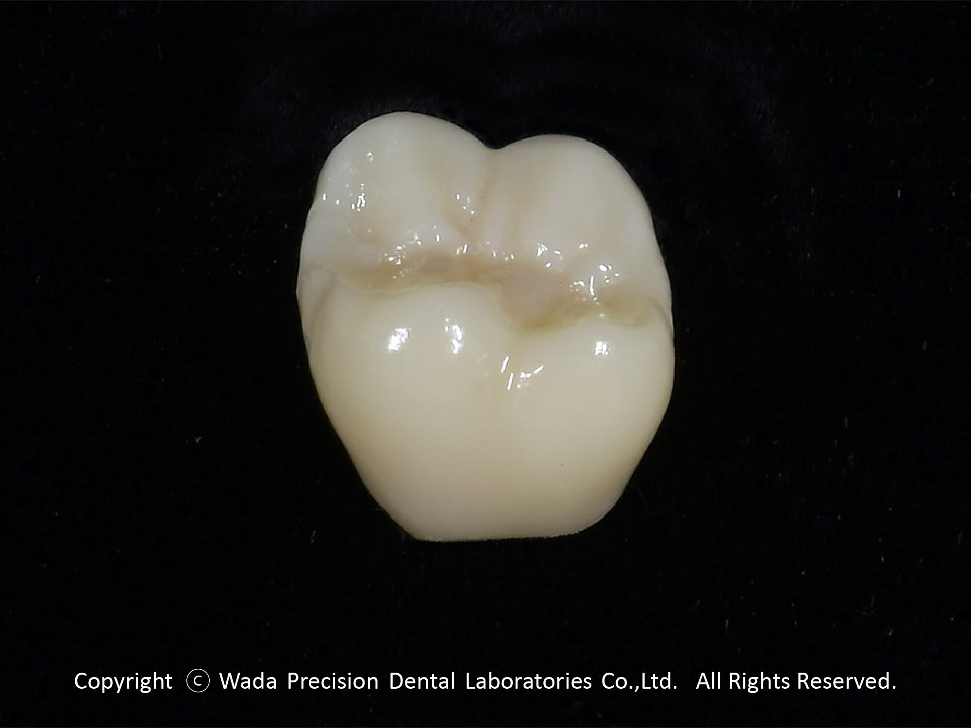 ZR-C ジルコニアクラウン - 【公式】和田精密歯研株式会社