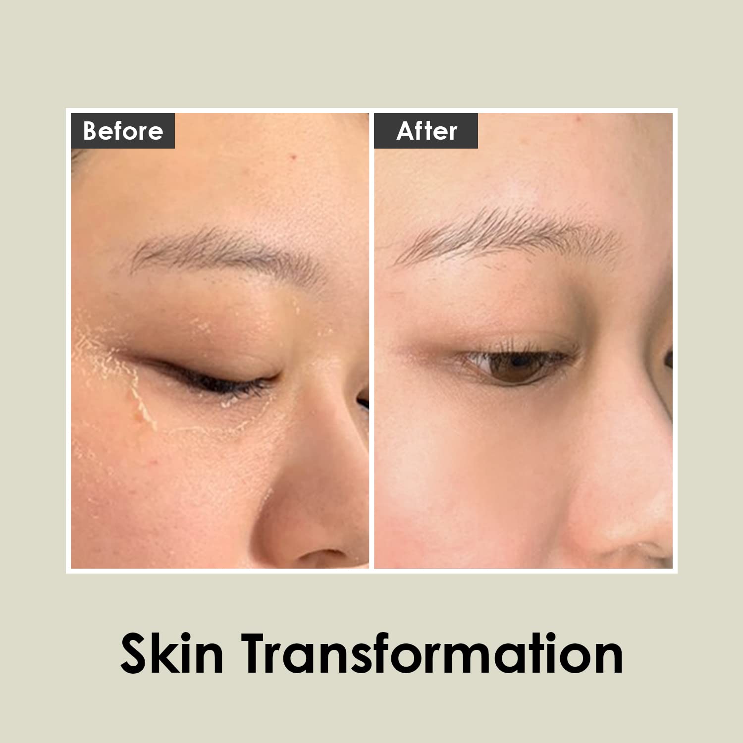 Amazon.com : MEDI-PEEL Herbal Peel Tox 4.23 fl oz / 120g | Peeling