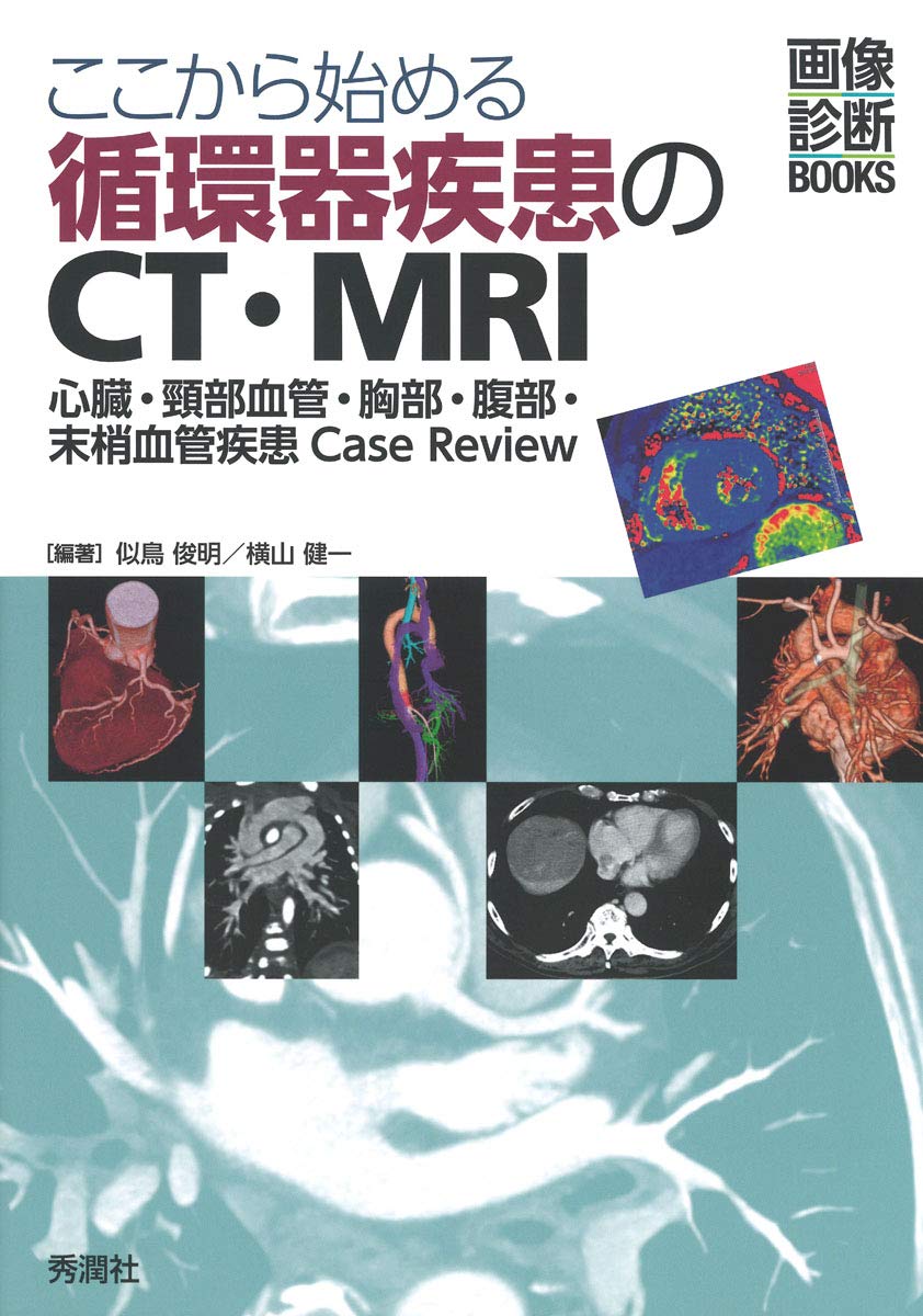 ここから始める循環器疾患のCT・MRI (画像診断BOOKS) | 似鳥俊明, 横山