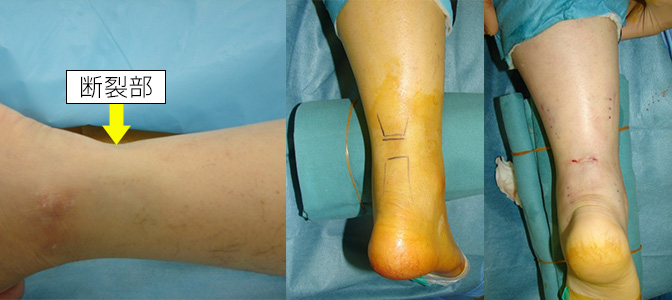 足の外科 | 聖マリアンナ医科大学 整形外科学講座