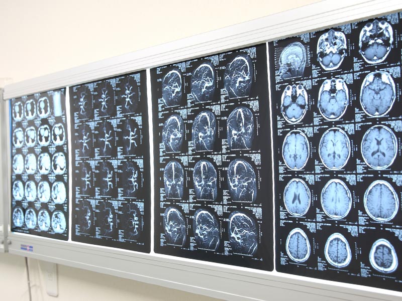 放射線科 | 新潟万代病院