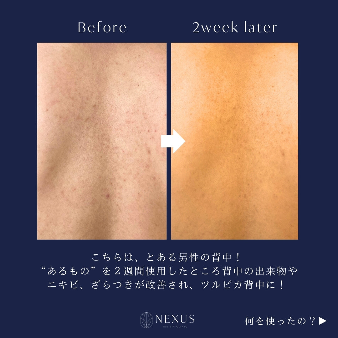 ZO® SKIN HEALTH ゼオスキンヘルス ボディエマルジョン | NEXUS ONLINE