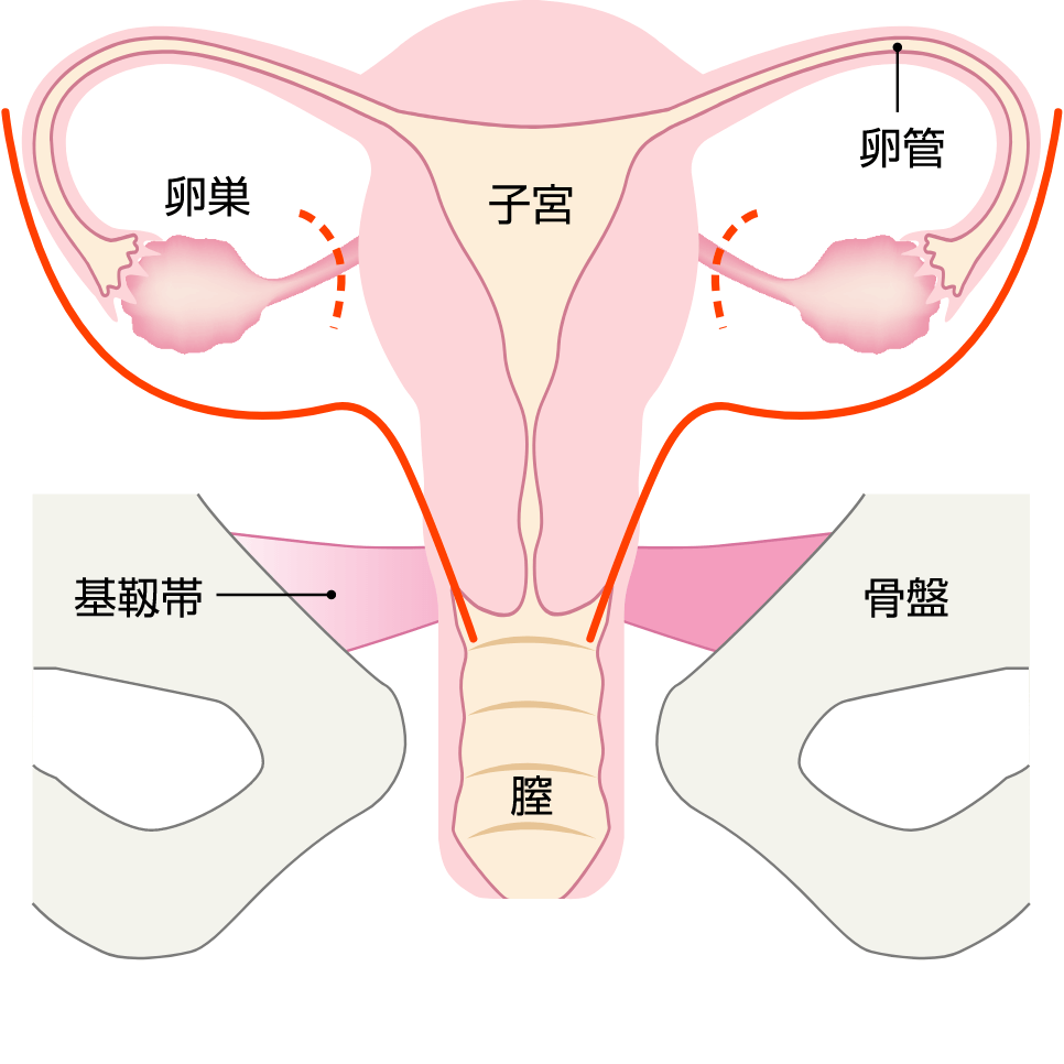 婦人科の手術 - 産科・婦人科の病気 | 日本医科大学多摩永山病院 女性