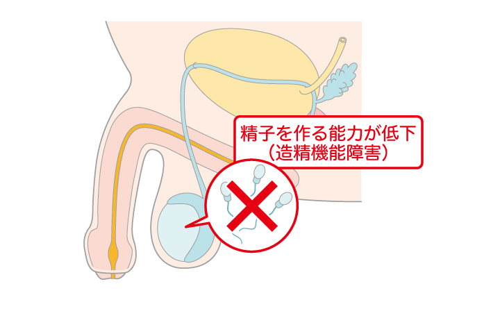 男性不妊症とは ｜ 男性不妊・メンズヘルス診療 プライベートケア
