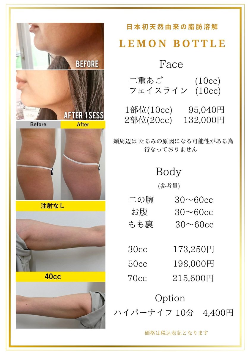 日本初！天然由来の脂肪溶解注射。DT無くサイズダウンが可能。海外で