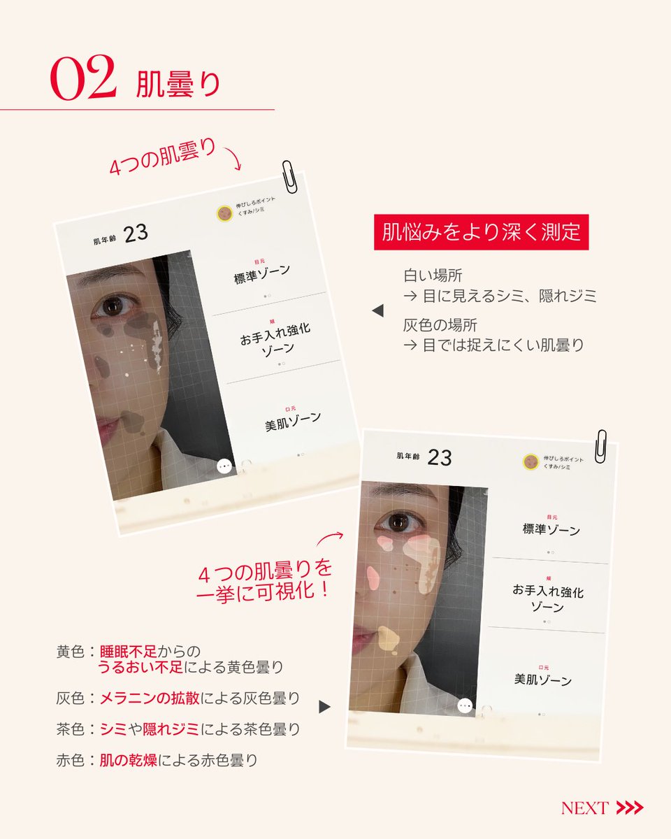 SK-IIの肌測定、何が見れるの？✨／​ SK-IIの肌測定器「マジック