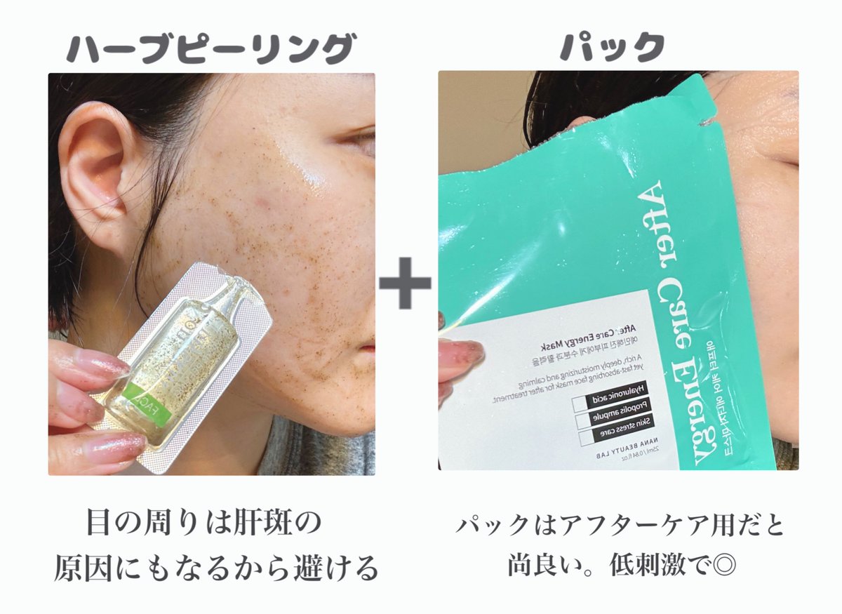 今夜はon:myskin（オンマイスキン）のハーブピーリングした🌿 マイルド