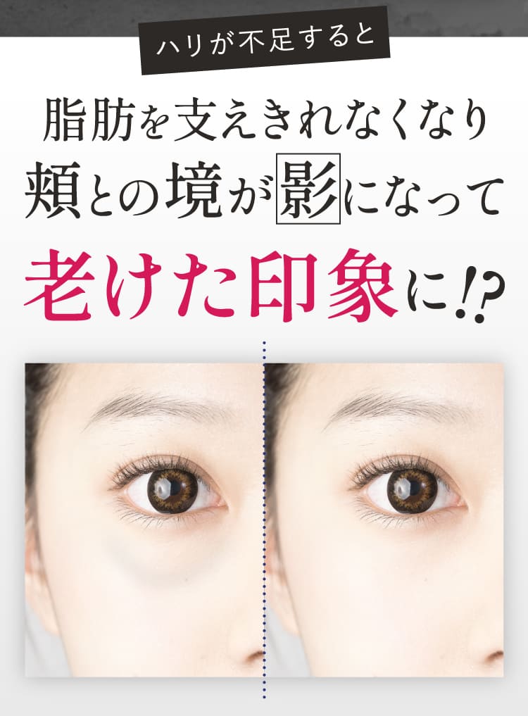 platinum hifu プラチナハイフ | spine