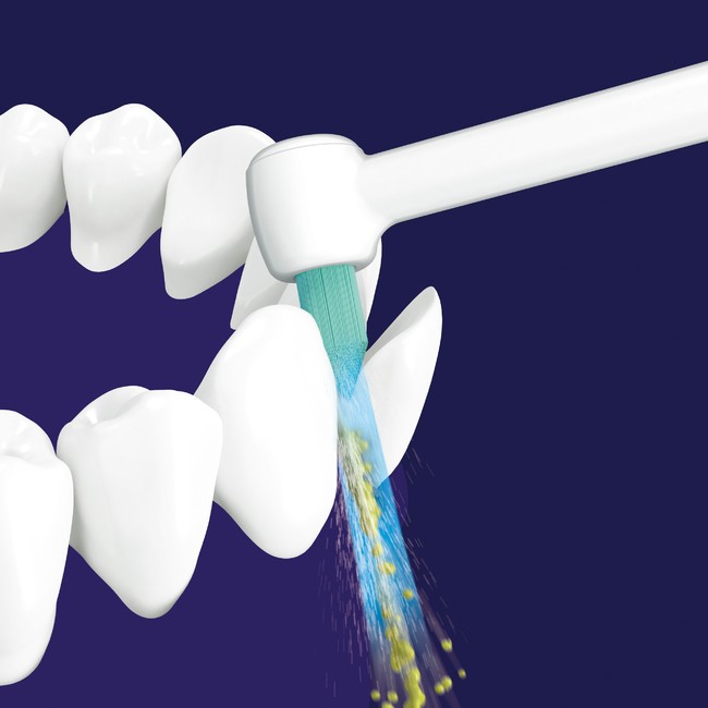 舌表面の汚れも洗浄できる「ジェットウォッシャー ドルツ EW-DJ74／EW