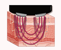 4D STYLE STINGER｜業務用エステ機器・化粧品の総合美容メーカー 株式