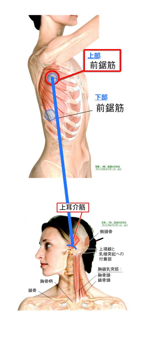 天城流湯治法 肩痛 腕痛 天城流マイスター 小松 隆