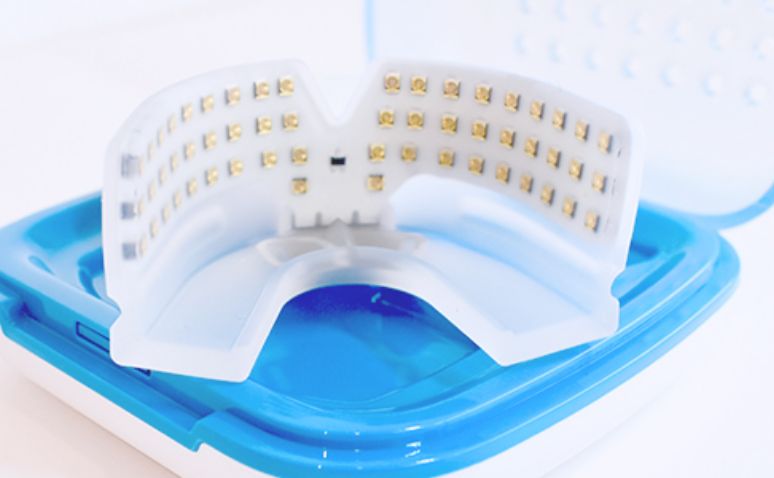 加速矯正装置（オルソパルス）【大宮駅2分】大宮SHIN矯正歯科