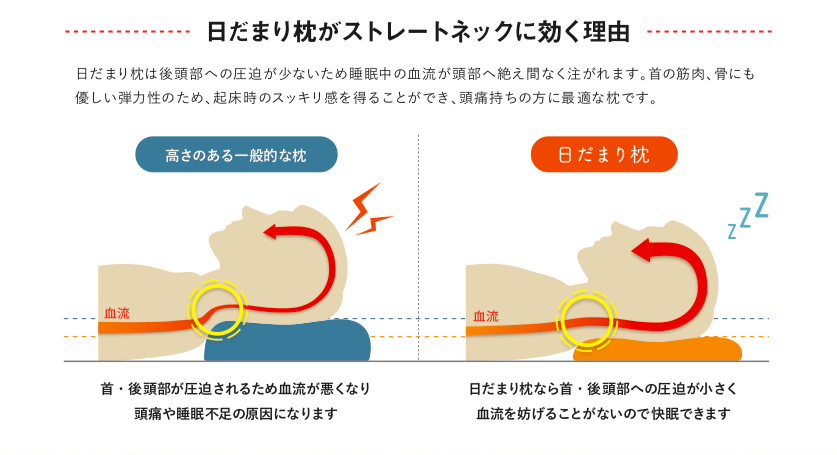 ストレートネック専用枕 | 信州頭痛整体院 雨のち晴れ