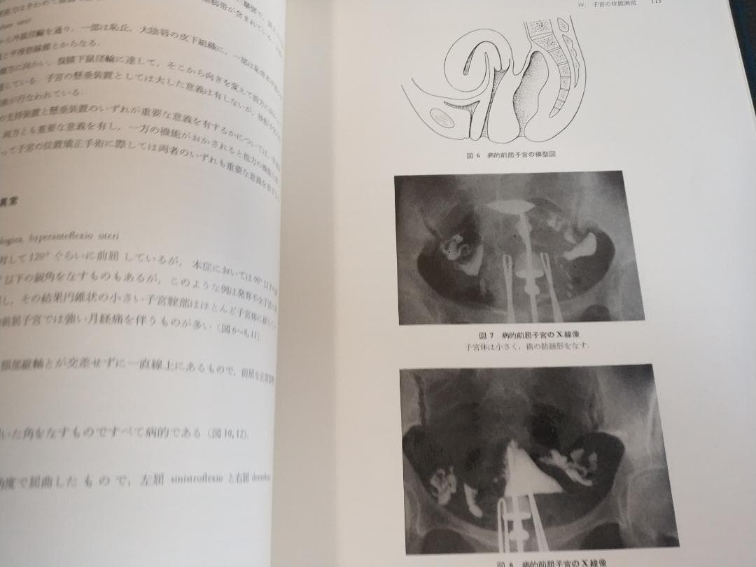 現代産科婦人科学大系〈8A〉女性性器の奇形 発育 位置異常 損傷 炎症1971年