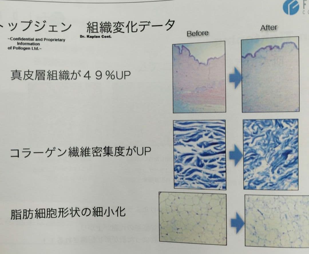 業務用 ラジオ波 エステマシン トライポーラ RF 値下げ交渉有り - メルカリ